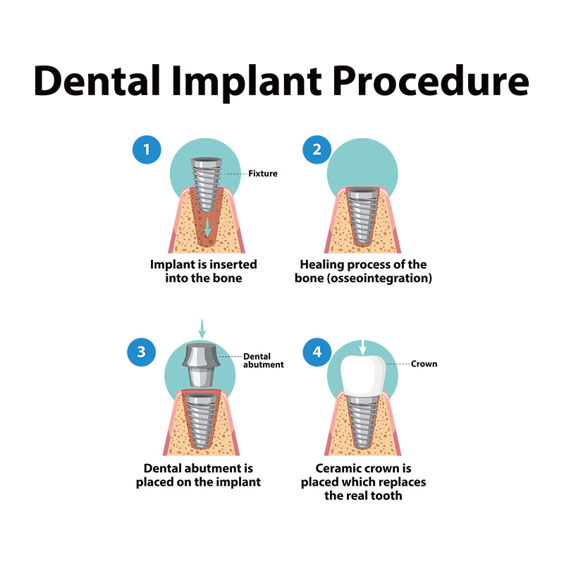 首页幻灯片Direct Dental Technology